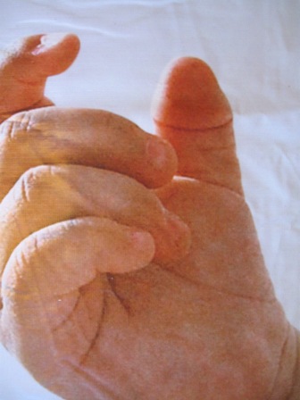 Powershop's Baby Trump's thumb looking like... a dick! 